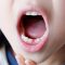 子供の歯の矯正（2）子供の歯並びを守るヒント　横浜市伊東歯科医院院長のコラム第3回